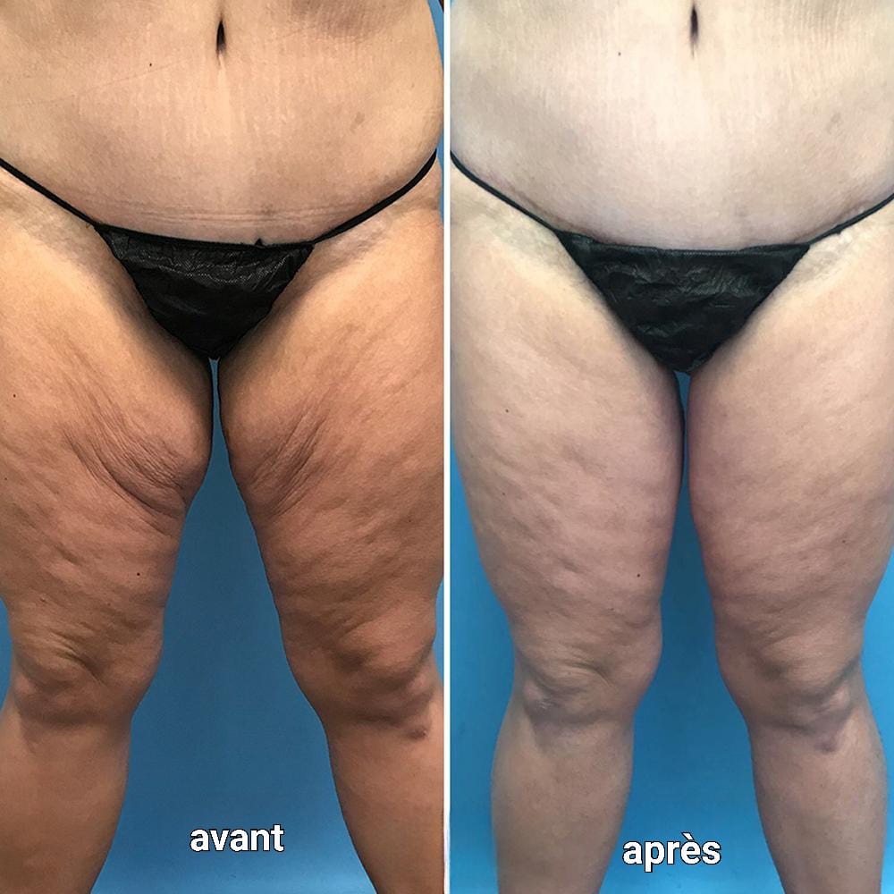 Aureva - Huile corporelle Rajeunissante - Aureva